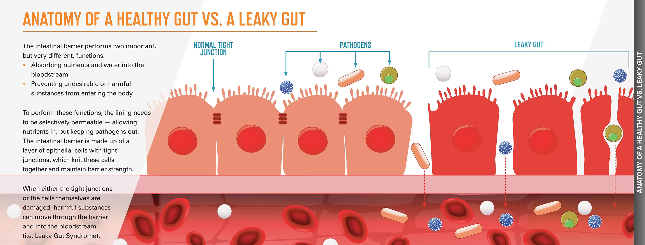 Healthy gut: tight junctions selectively allow nutrients while blocking pathogens. Damage causes leaky gut syndrome.