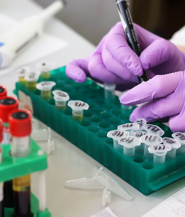 Person in purple gloves using a pipette on a green test tube rack in a laboratory setting.